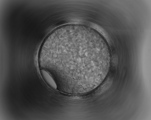X0000087511283200705180948