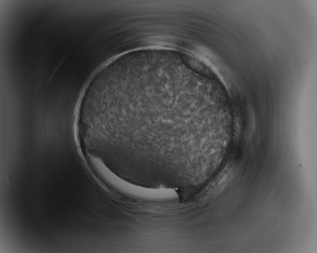 X0000087511379200705180947