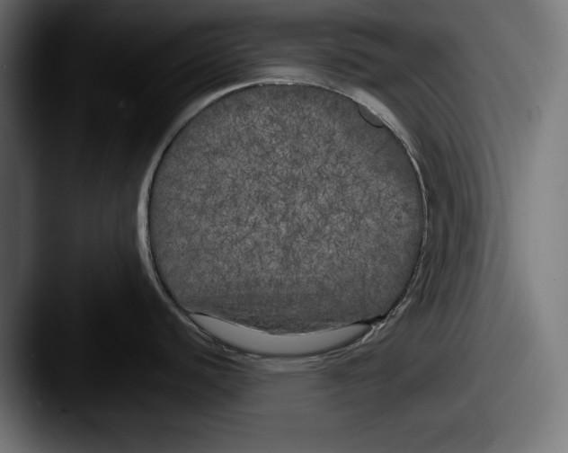X0000087511440200705180946