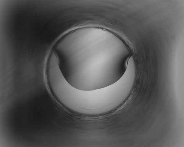 X0000087511518200705180945