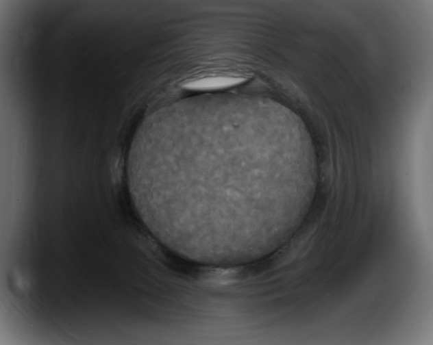 X0000087510081200705251628