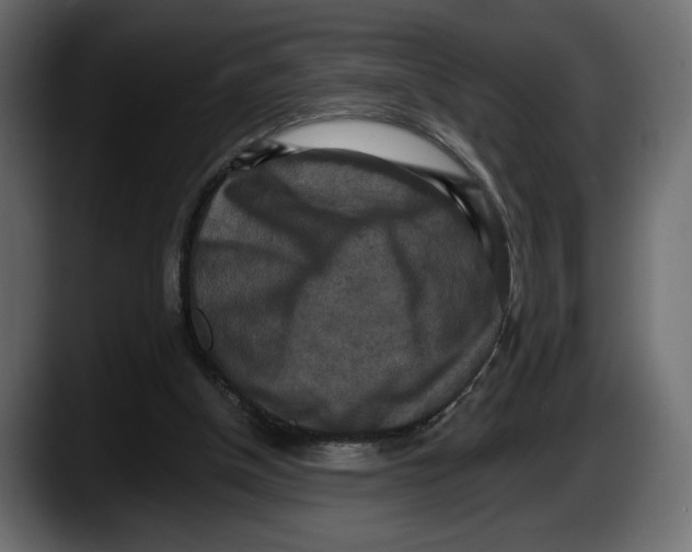 X0000087510154200705251626