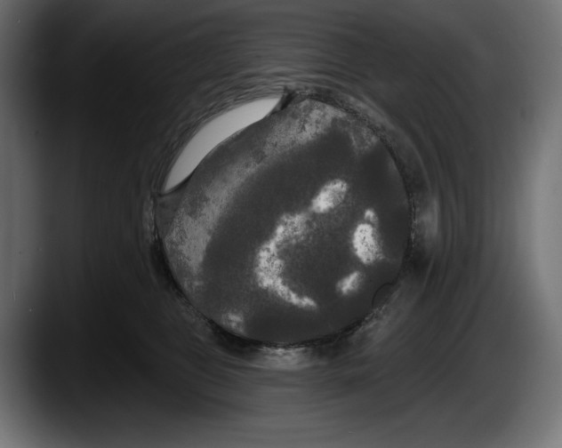 X0000087510469200705251622