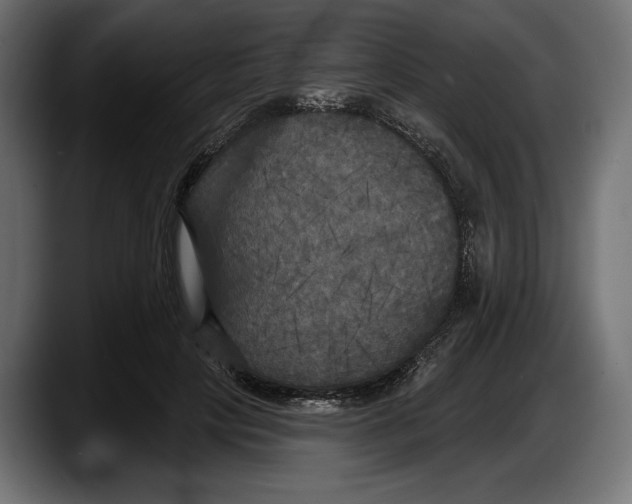 X0000087510649200705251620