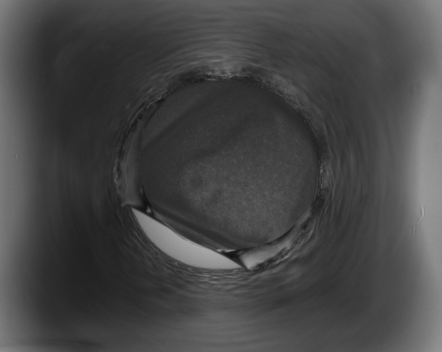 X0000087511202200705251612