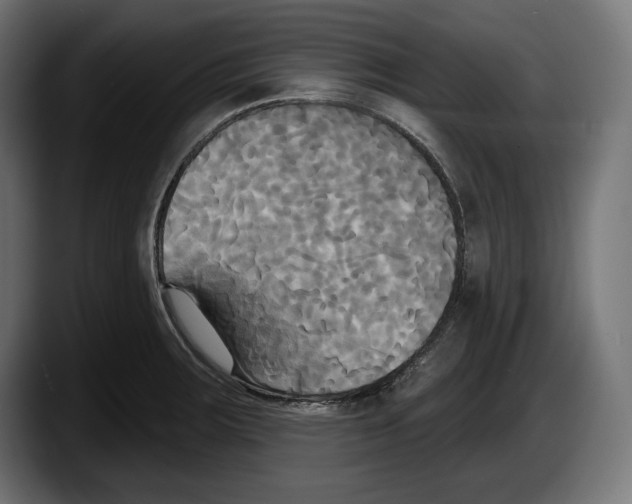 X0000087511283200705251611