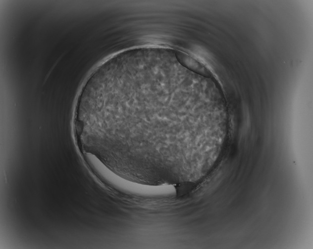 X0000087511379200705251610