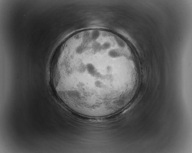 X0000087511415200705251609