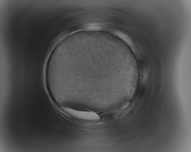 X0000087511475200705251609