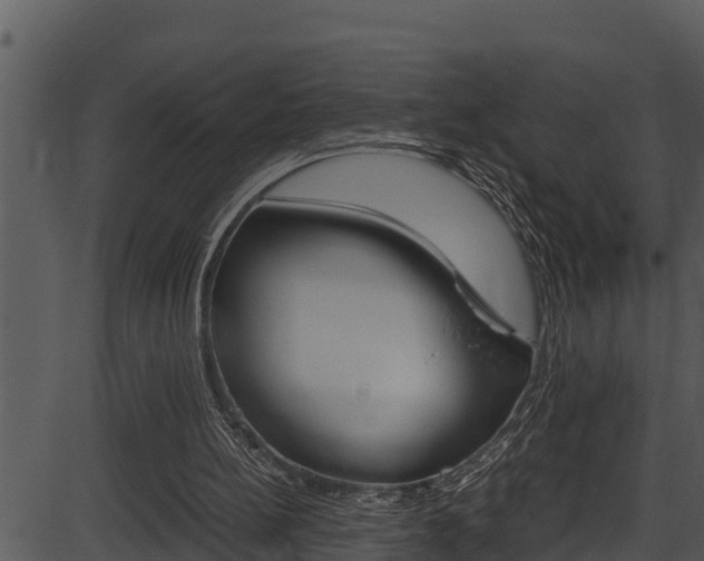 X0000087520148200704270827