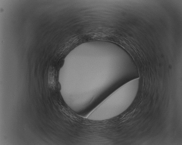 X0000087521250200704270810