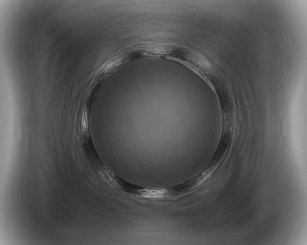 X0000087520143200704271147