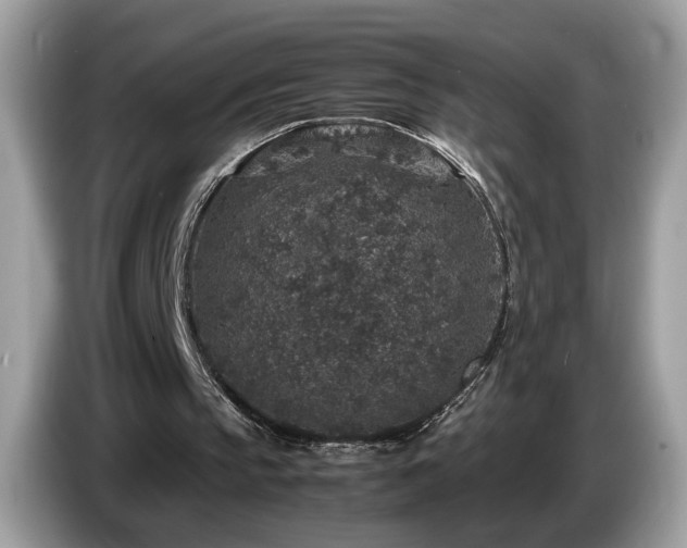 X0000087520145200704271146