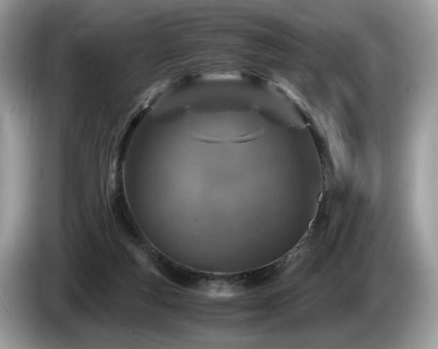 X0000087520163200704271146