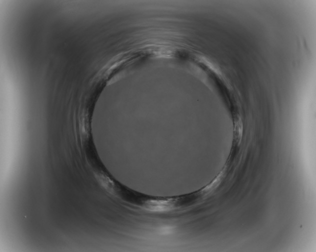 X0000087520170200704271147