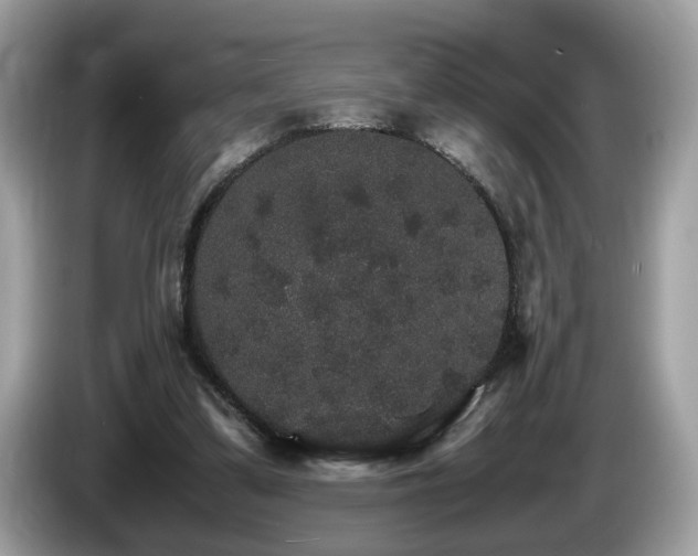 X0000087520299200704271145