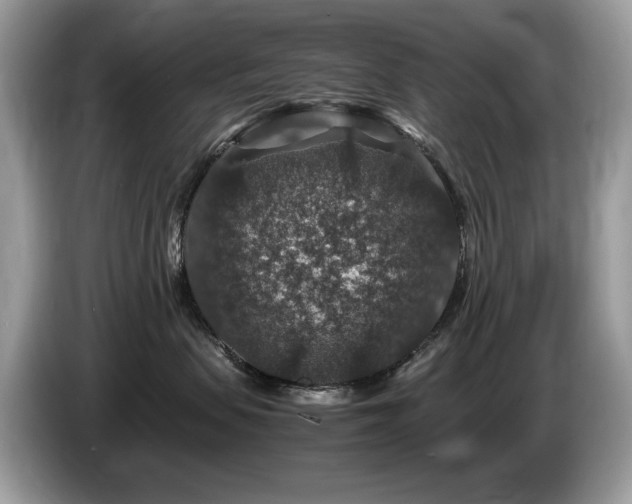 X0000087520479200704271143