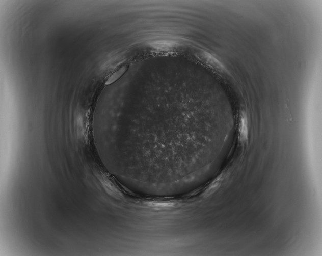 X0000087520868200704271138
