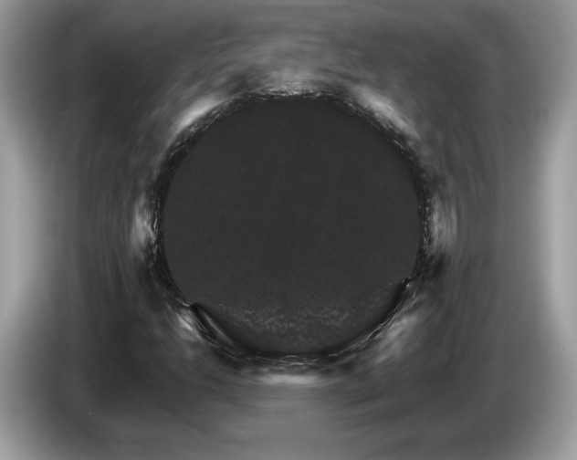 X0000087521206200704271134