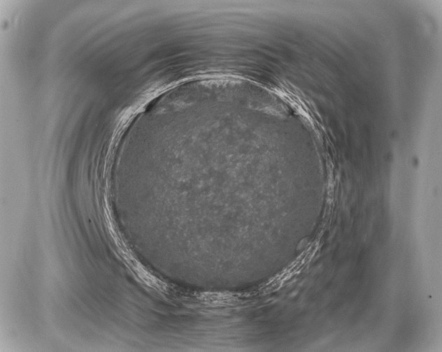 X0000087520145200705041221