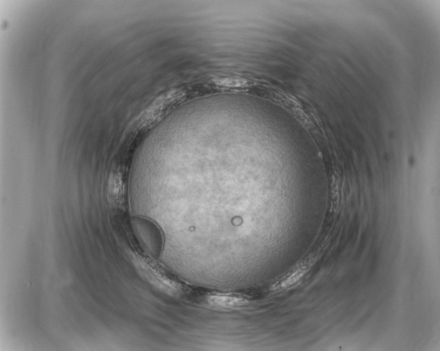 X0000087520614200705041214