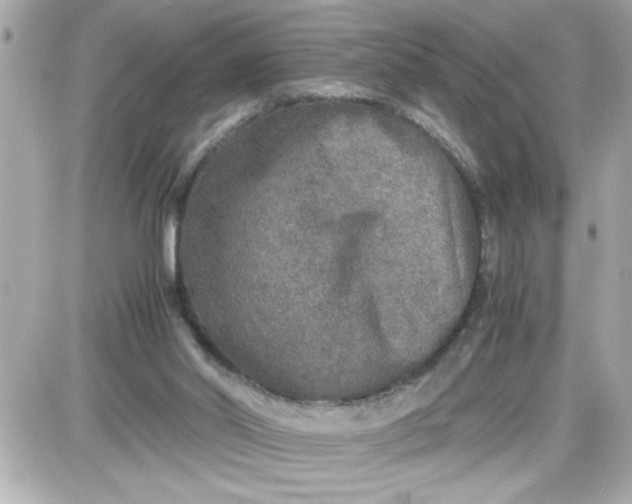 X0000087520014200705112018