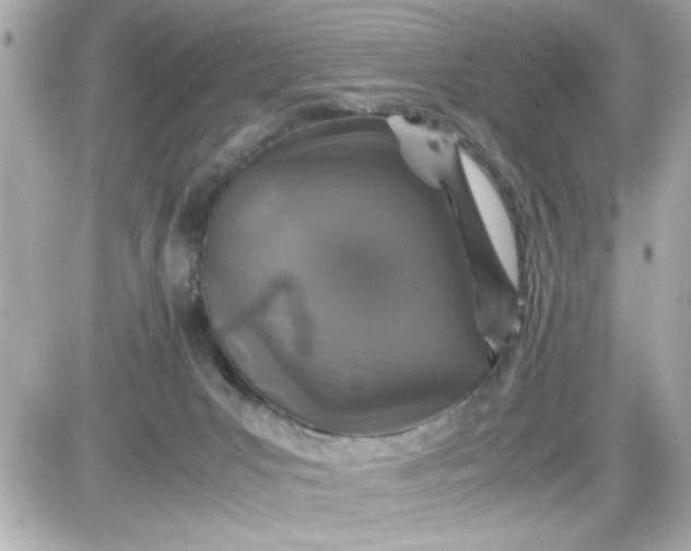 X0000087520031200705112017