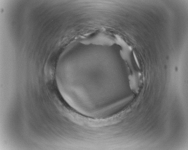 X0000087520039200705112017