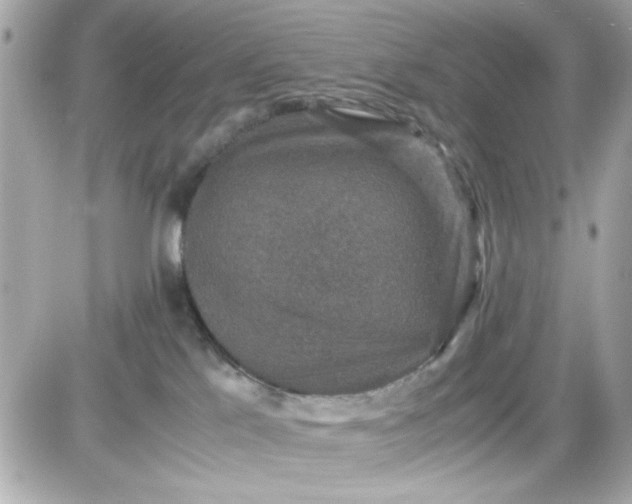 X0000087520041200705112017