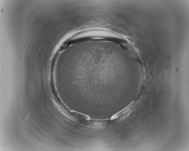 X0000087520056200705112016