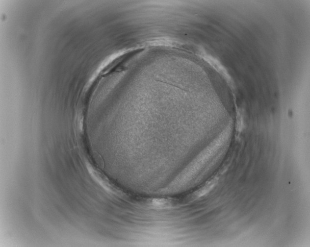 X0000087520060200705112016