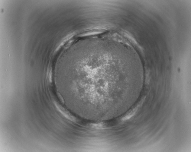 X0000087520068200705112017