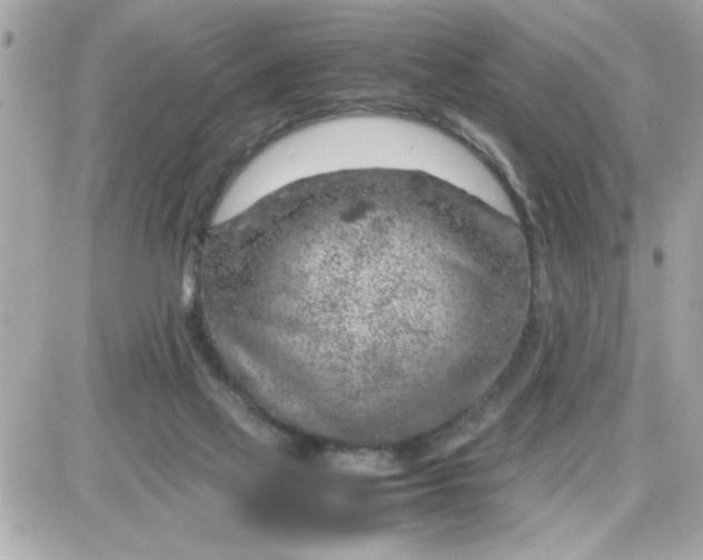 X0000087520069200705112017