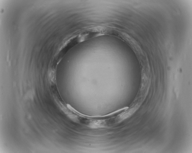 X0000087520096200705112017