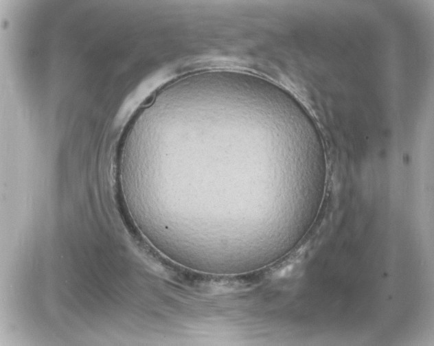 X0000087520103200705112016