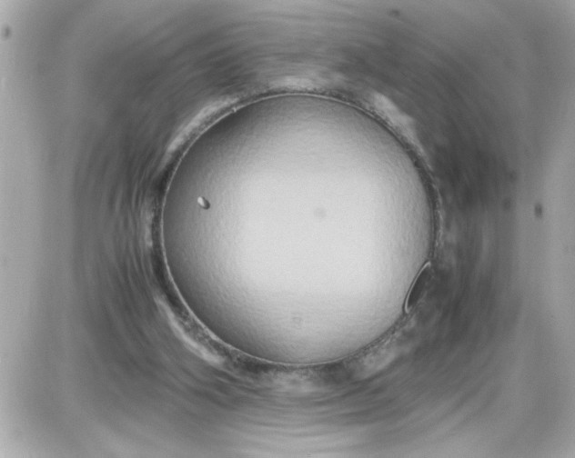 X0000087520106200705112016