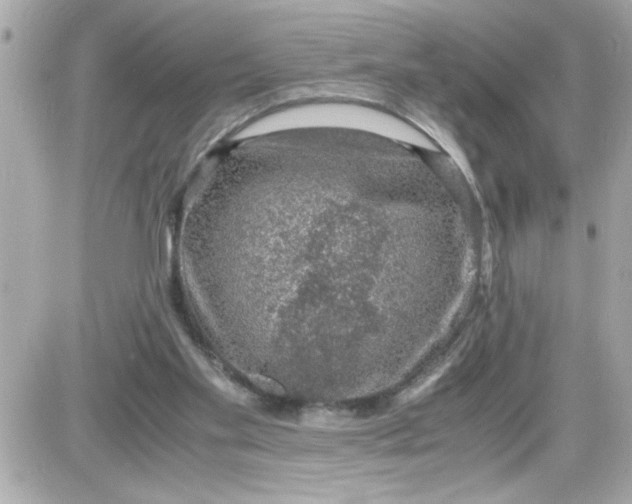 X0000087520109200705112016