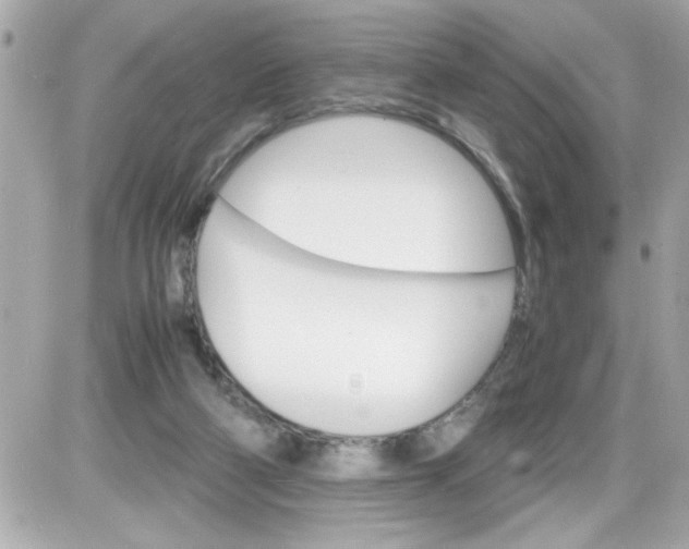 X0000087520114200705112016