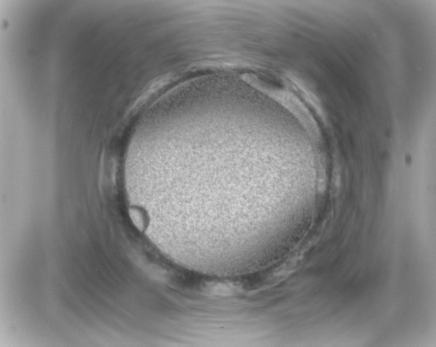 X0000087520115200705112016