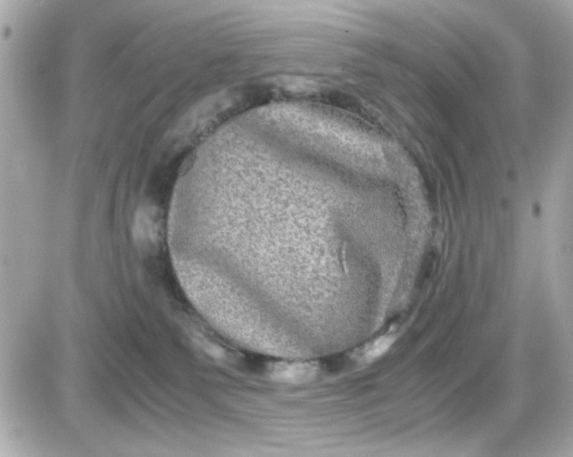 X0000087520135200705112016