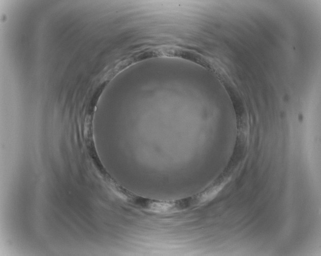 X0000087520139200705112016