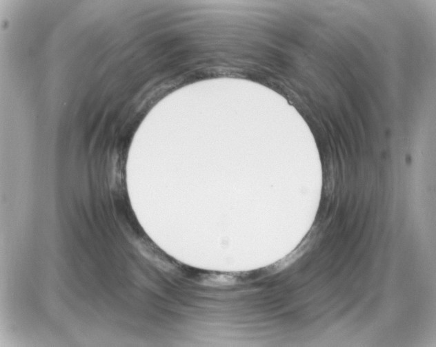 X0000087520140200705112016