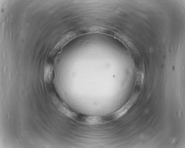 X0000087520142200705112015