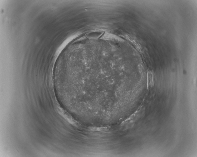 X0000087520147200705112015