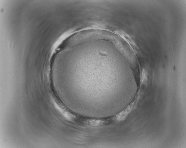 X0000087520152200705112015