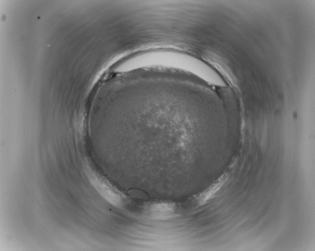 X0000087520156200705112015