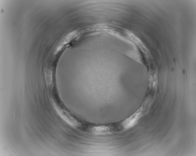 X0000087520158200705112015