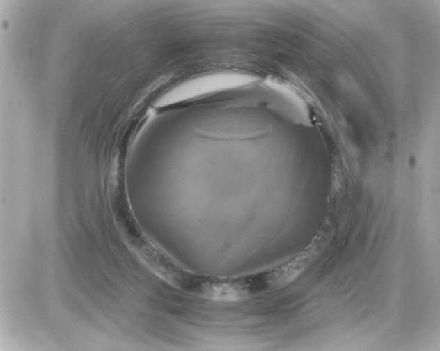 X0000087520163200705112015