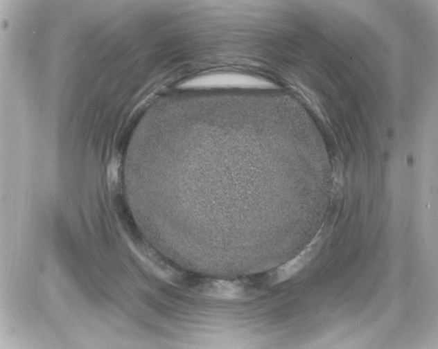 X0000087520166200705112015