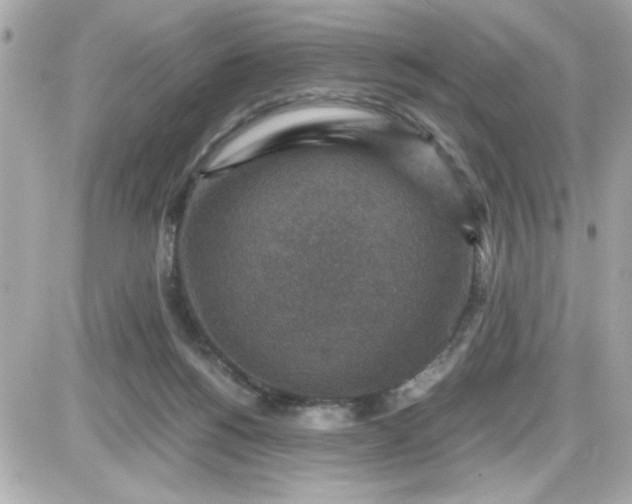 X0000087520168200705112015